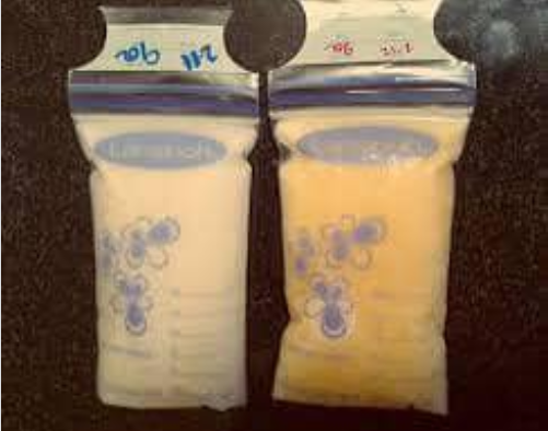 Materské mlieko počas choroby dojčenie kojenie bábätko laktácia